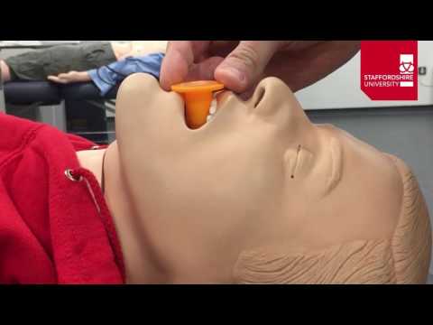 Oropharyngeal Airway Insertion