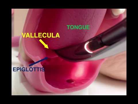 Airway Devices 01: Direct Laryngoscopy